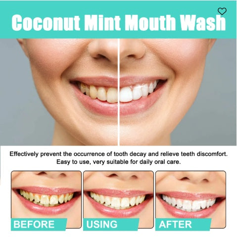 Coconut Mint Mouth Wash