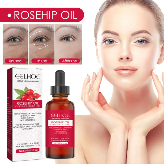 EELHOE Rosehip Oil For Facial And Body Hydration